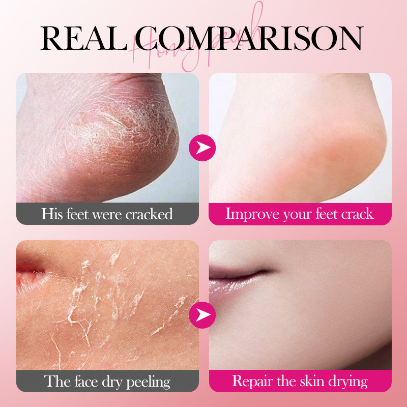 Full English SADOER Anti-Cracking Squalane Peach Foot Cream Anti-cracking Care Foot Cream Cross-border export wholesale Application Scenario