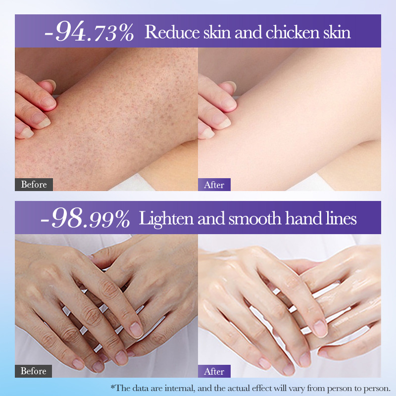 Cross-border export wholesale of SADOER Super Moisturizing Fragrance Set for hydrating the skin, body lotion and hand cream Application Scenario
