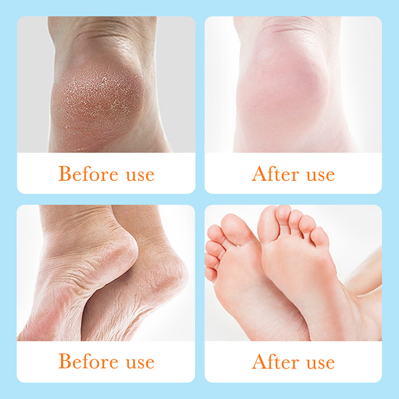 SADOER Foot Anti-chapping Gel improves anti-dryness and cracking, moisturizes and wading, cross-border export wholesale Item Picture