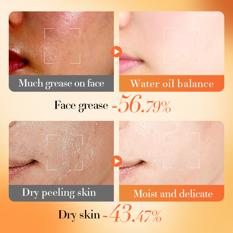 All-english BIOAOUA Vitamin EB5 Moisturizing Multi-Dimensional Repair Toner and Moisturizing Water cross-border export wholesale Item Picture