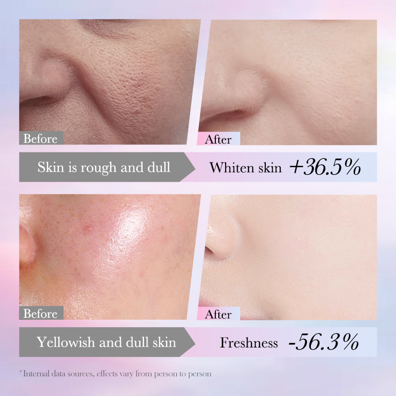 Cross-border export wholesale of SADOER niacinamide Whitening, freckle-removing and Repairing Lotion for brightening the skin in full English Application Scenario