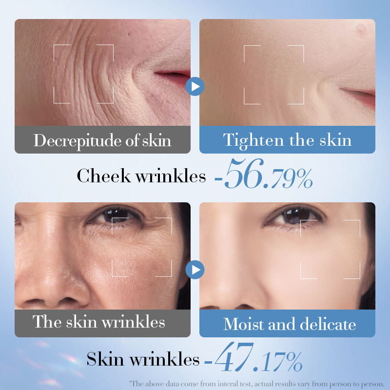 SADOER Retinol VE Firming and Anti-Wrinkle Cream Moisturizing and Hydrating Cream Cross-border export wholesale Item Picture