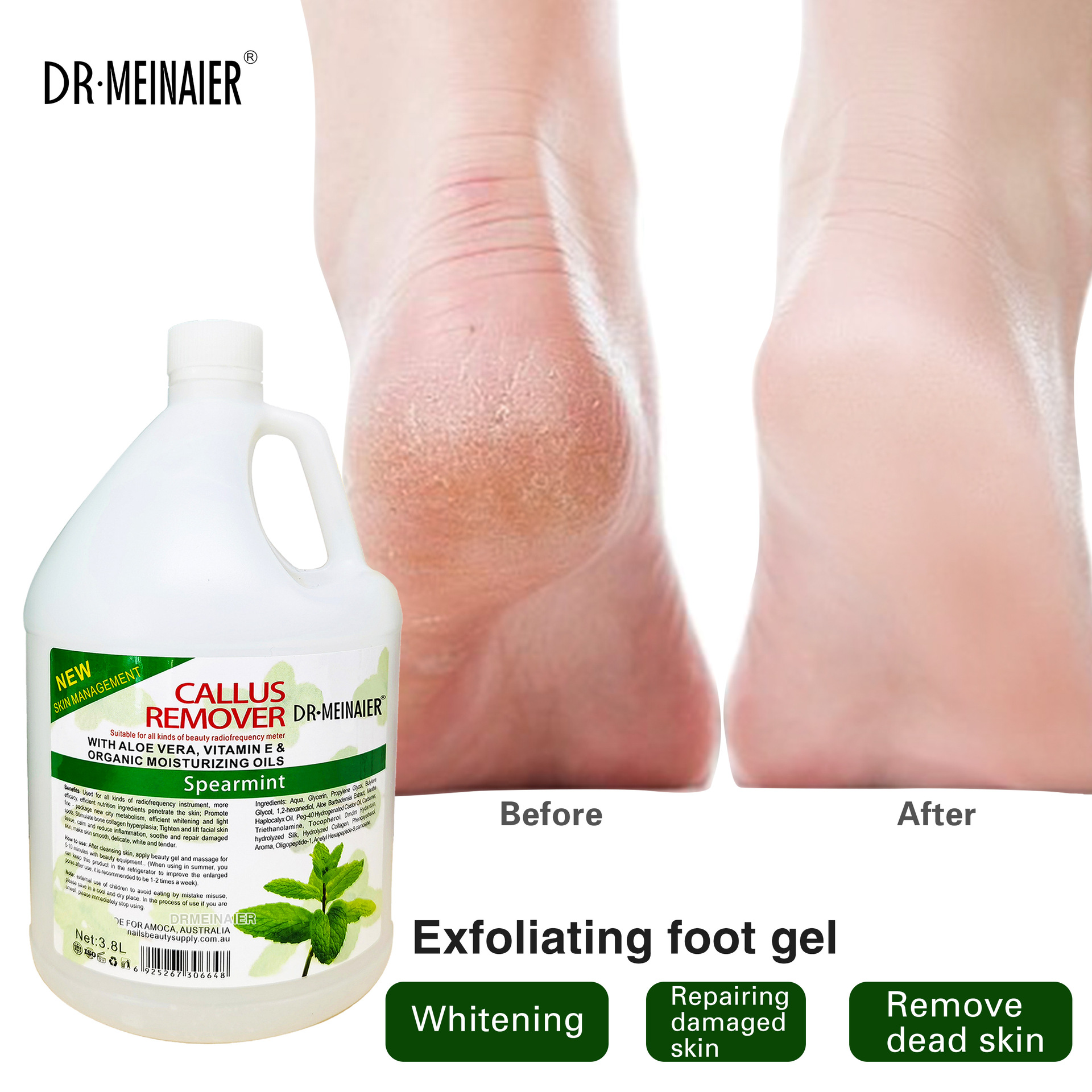 Cross-border exfoliating gel, gentle deep cleansing, ultrasonic full-body hydrating, moisturizing, exfoliating, wholesale for export full figure