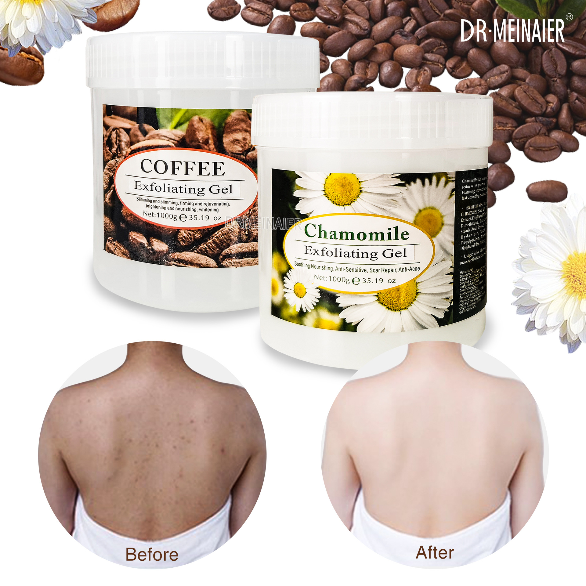 Cross-border facial and body exfoliating gel, a gentle moisturizing exfoliating gel, deeply cleanses pores and skin Application Scenario