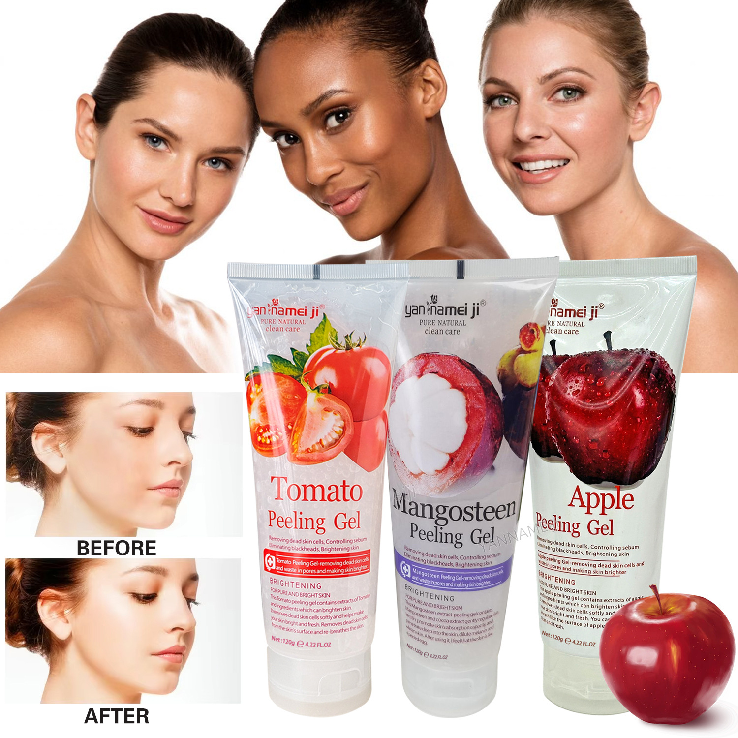 Cross-border pomegranate Exfoliating Gel 120g Tomato Exfoliating Gel Eraser Gentle Cleansing Export wholesale Application Scenario