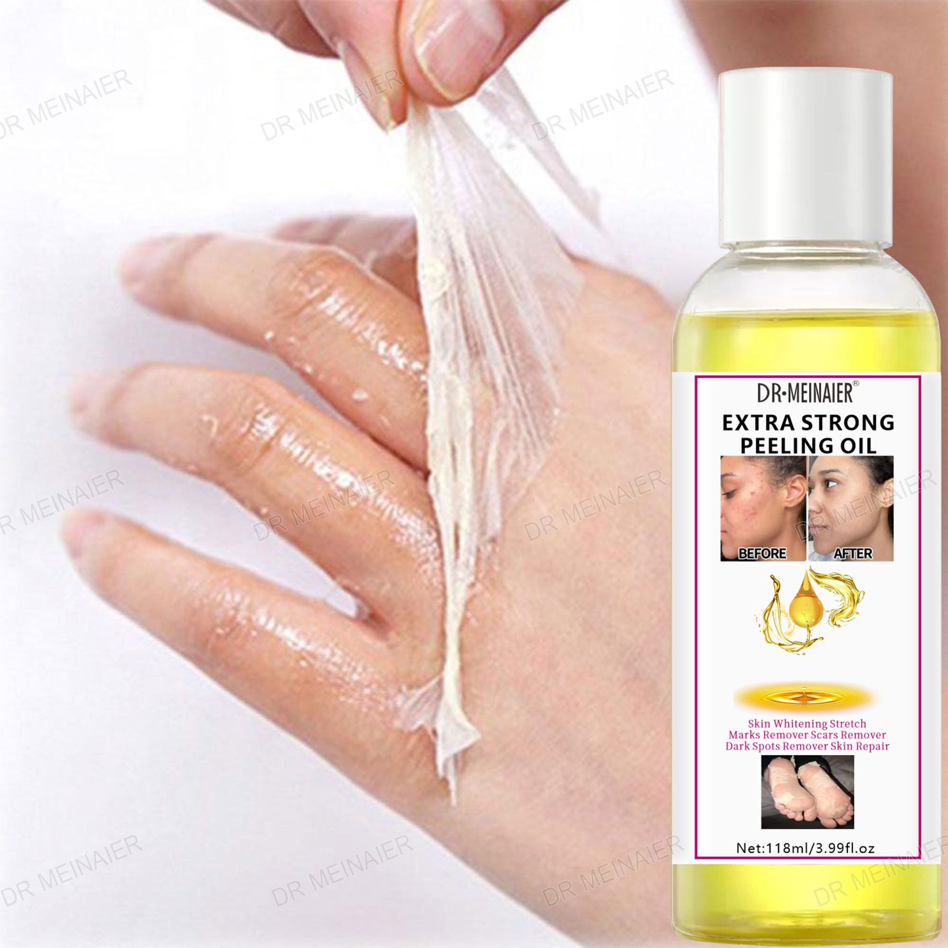 Peeling Oil, cross-border peeling oil, whitening, exfoliating, fading spots, brightening the skin, hand, face and body care full figure