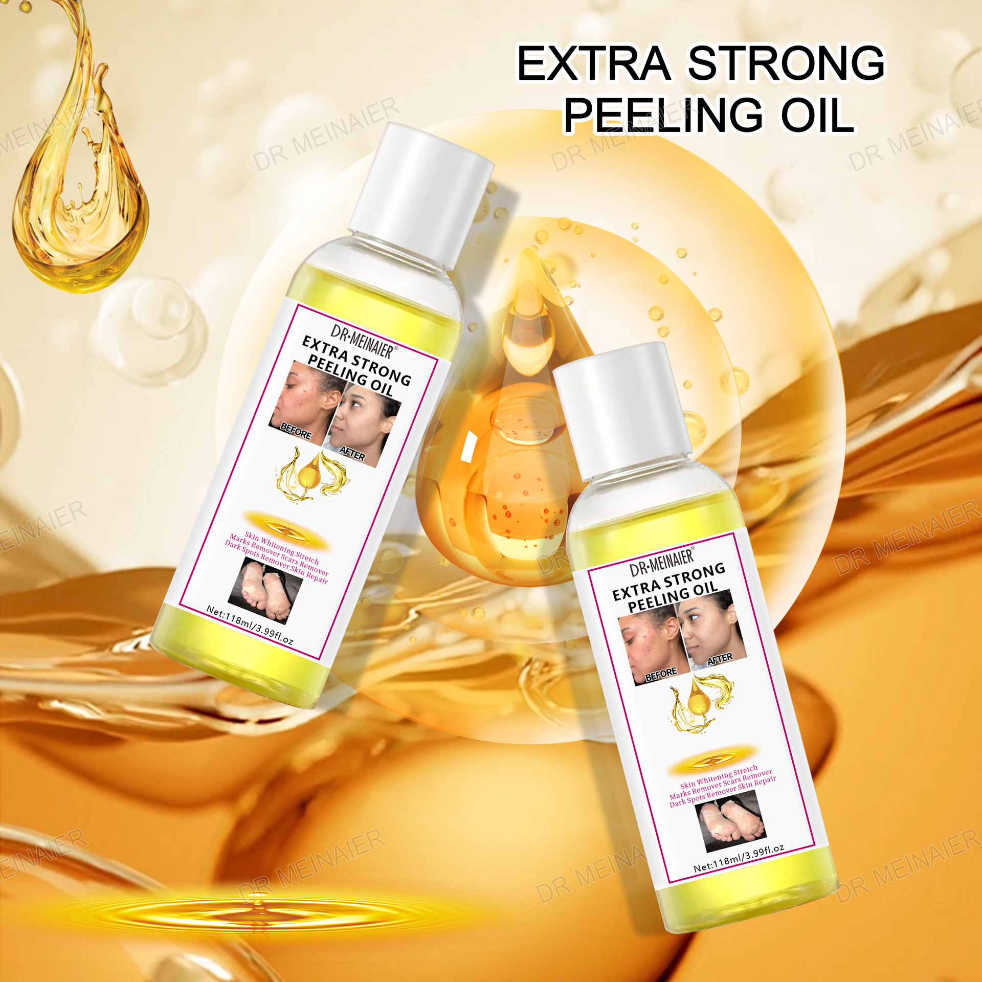 Peeling Oil, cross-border peeling oil, whitening, exfoliating, fading spots, brightening the skin, hand, face and body care details Picture