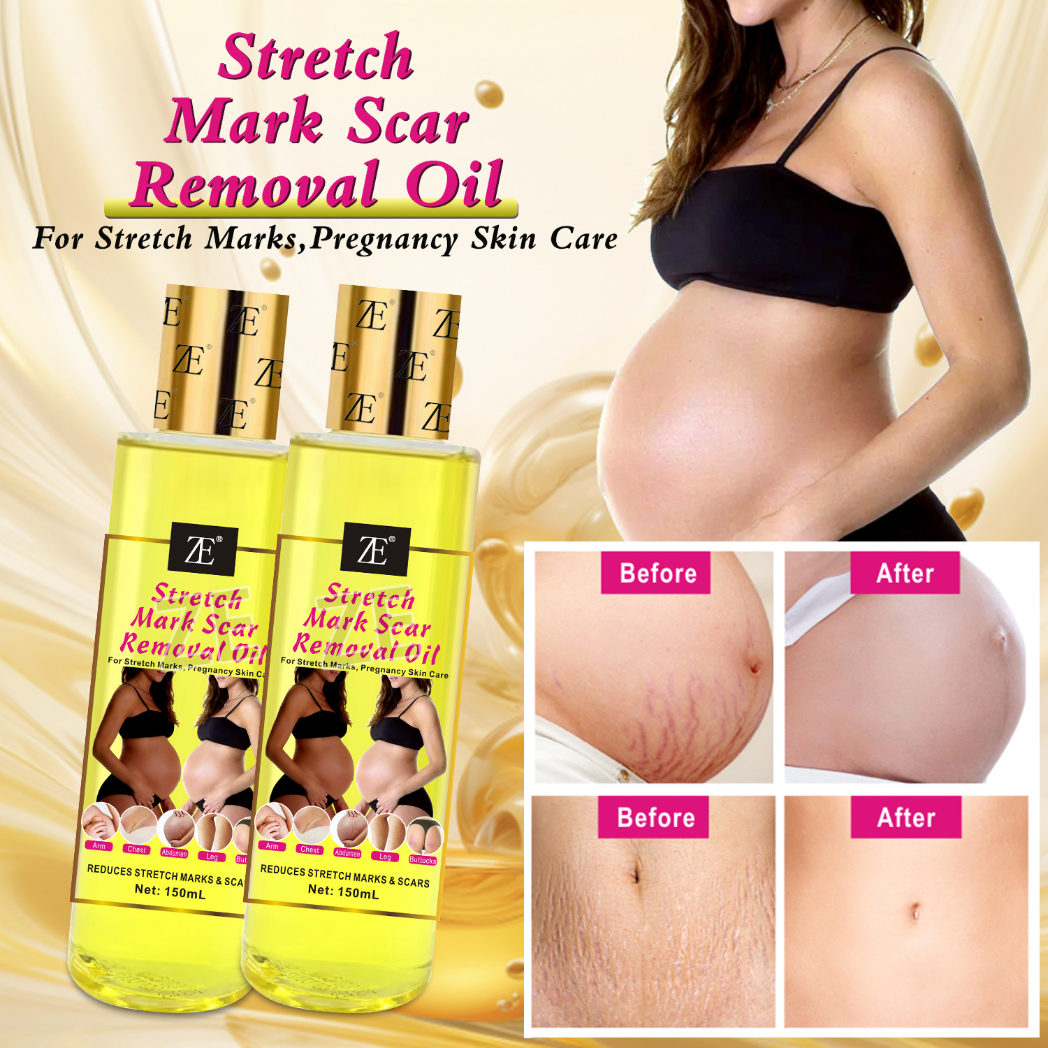Cross-border Body Oil Stretch Mark Oil for Pregnant Women to Repair, firm and moisturize, and to fade Fine lines. Massage Essential Oil 150m full figure
