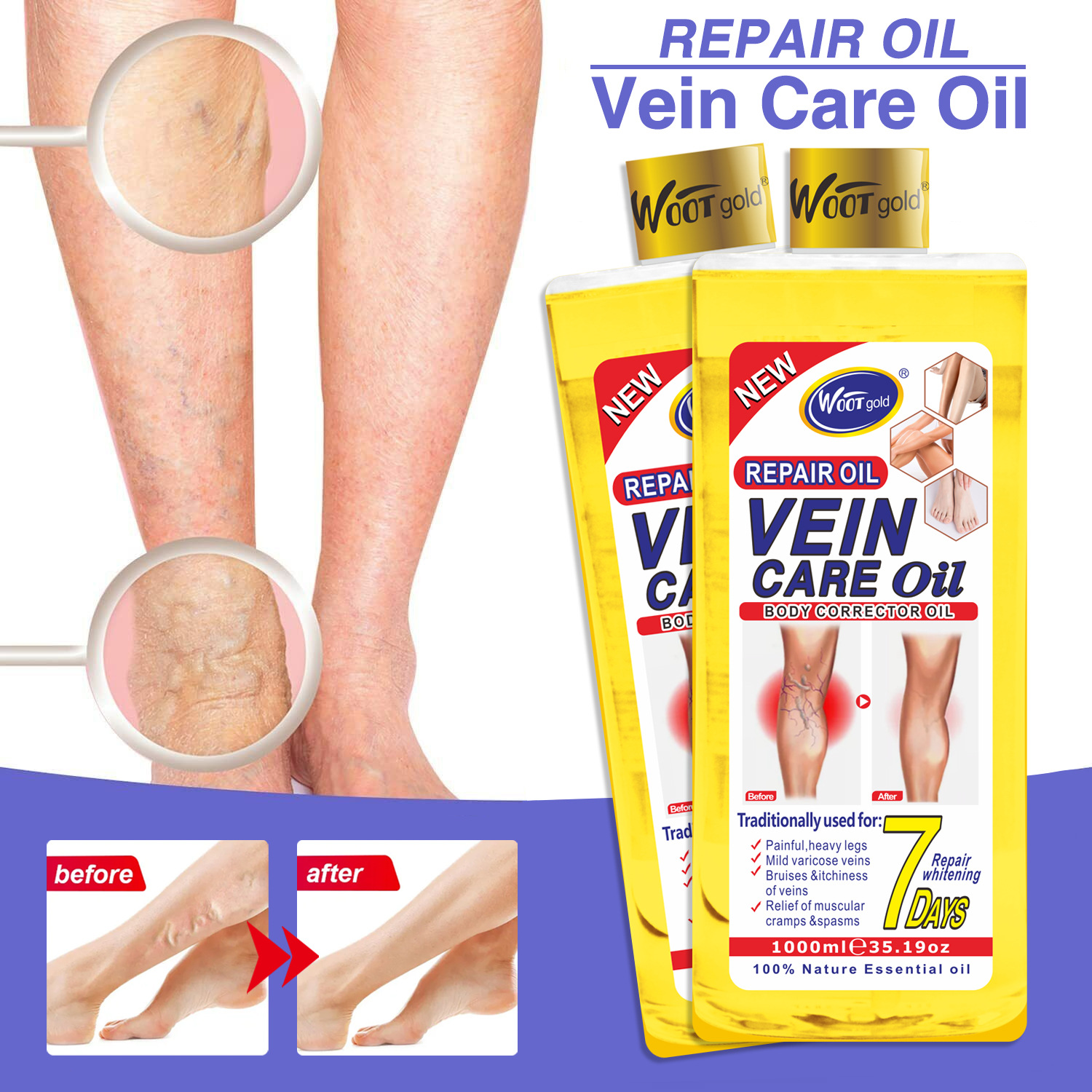 Cross-border Foreign Trade WOOTgold Vein Relaxation Essential Oil Earthworm Leg Relaxation and Leg Massage Oil 1000 full figure