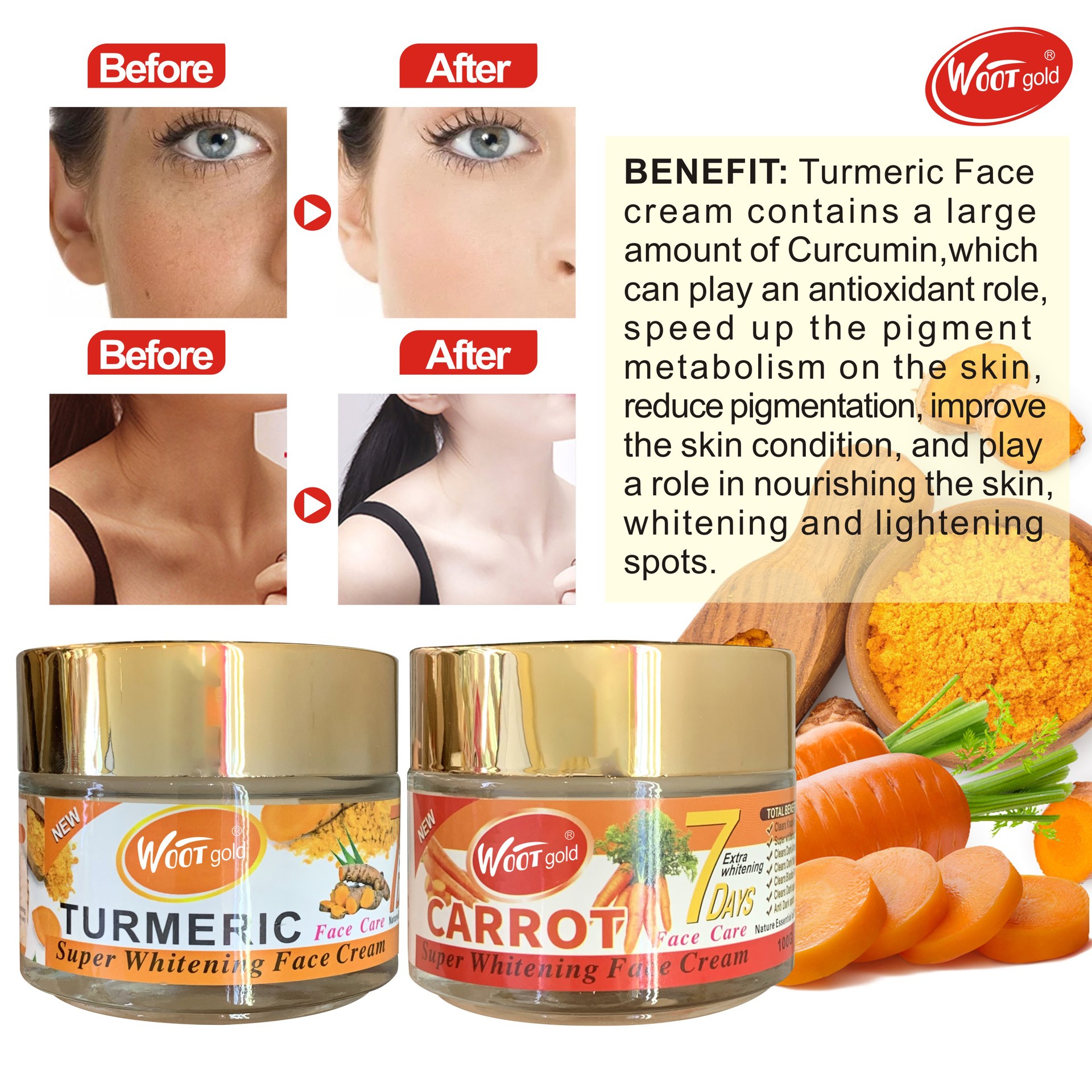 Cross-border face cream Turmeric Cream 100G Brightening, Darkening, Moisturizing, Hydrating and Firming Almond Moisturizing Lotion Application Scenario