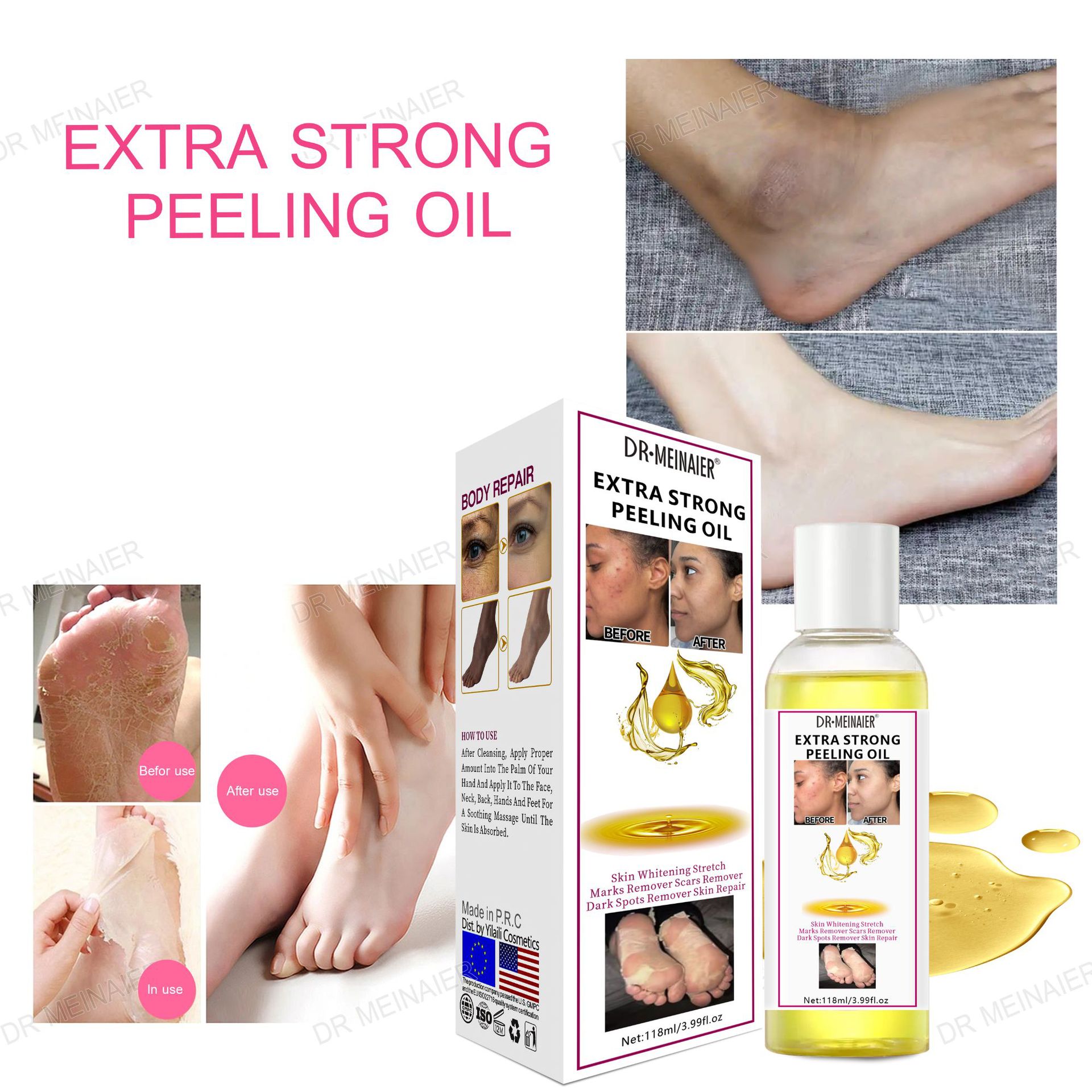 Peeling Oil, cross-border peeling oil, whitening, exfoliating, fading spots, brightening the skin, hand, face and body care Application Scenario