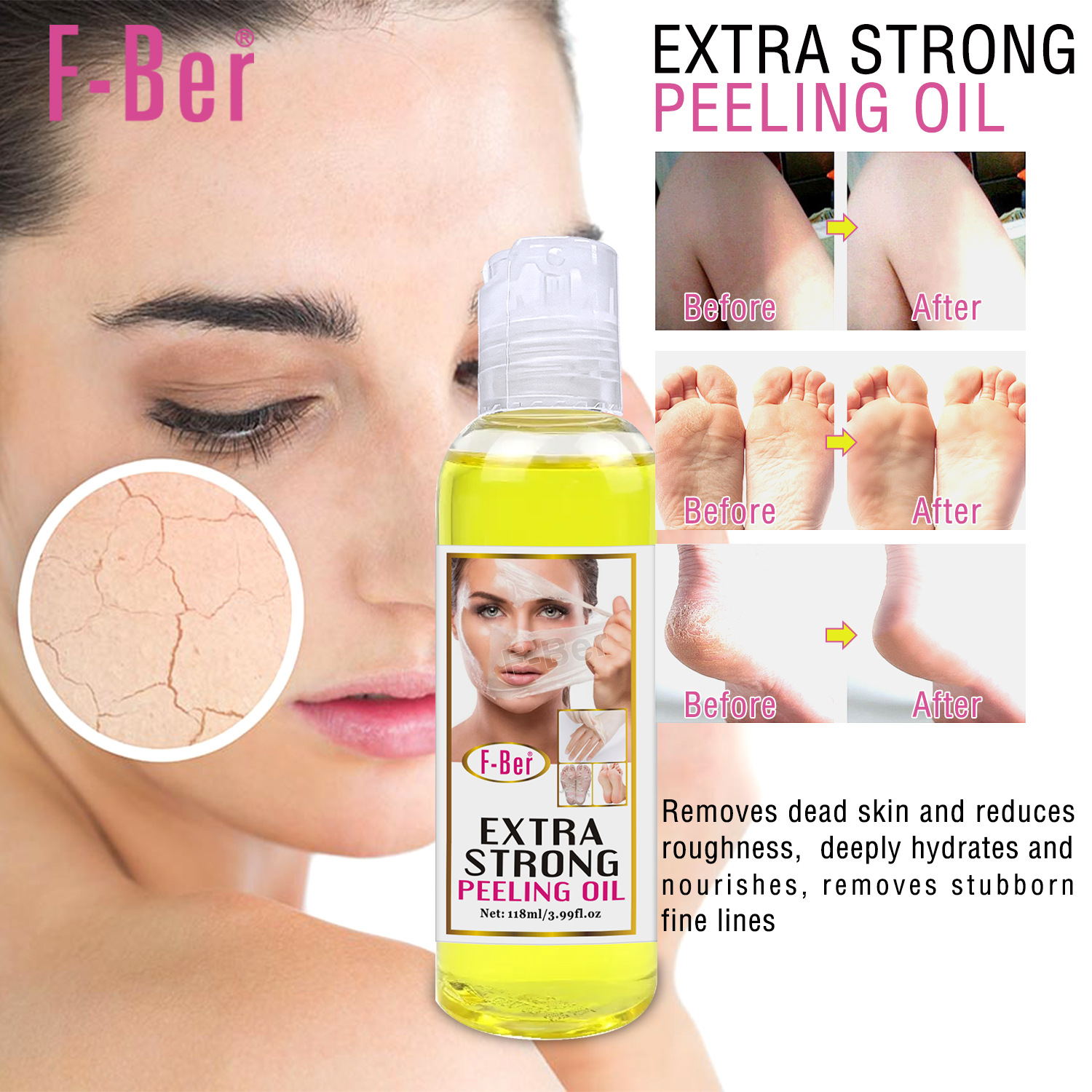 Cross-border foreign trade peeling oil for hands and feet, exfoliating and removing dead skin, body care oil for moisturizing and repairing details Picture