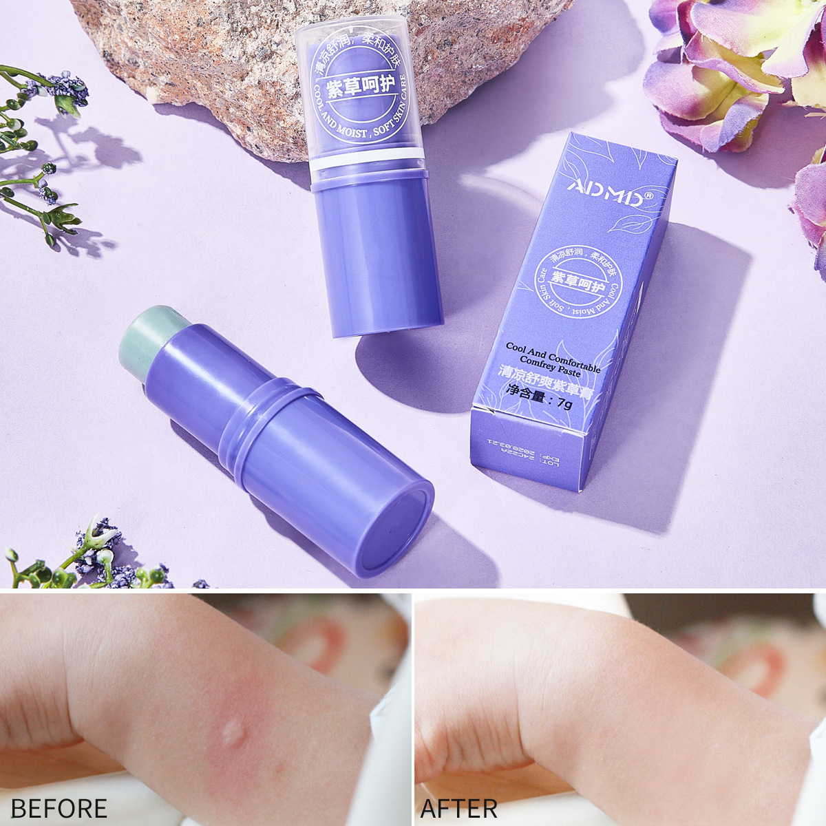 ADMD Cool and Refreshing Lithospermum Ointment is slightly cool and refreshing when applied to the skin. It has a refreshing and soothing fragrance, providing skin comfort, relieving itching and repelling mosquitoes. Wholesale details Picture