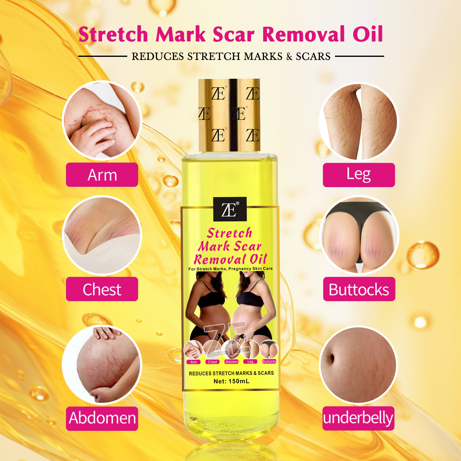 Cross-border Body Oil Stretch Mark Oil for Pregnant Women to Repair, firm and moisturize, and to fade Fine lines. Massage Essential Oil 150m details Picture