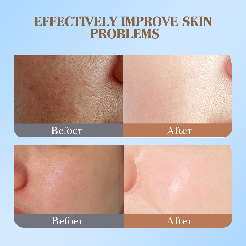 Dear she Coconut Milk Essence Hydrating, Moisturizing, Nourishing and Repairing Facial Skin Care Smooth Mask is selling well in Southeast Asia foreign trade Factory Item Picture