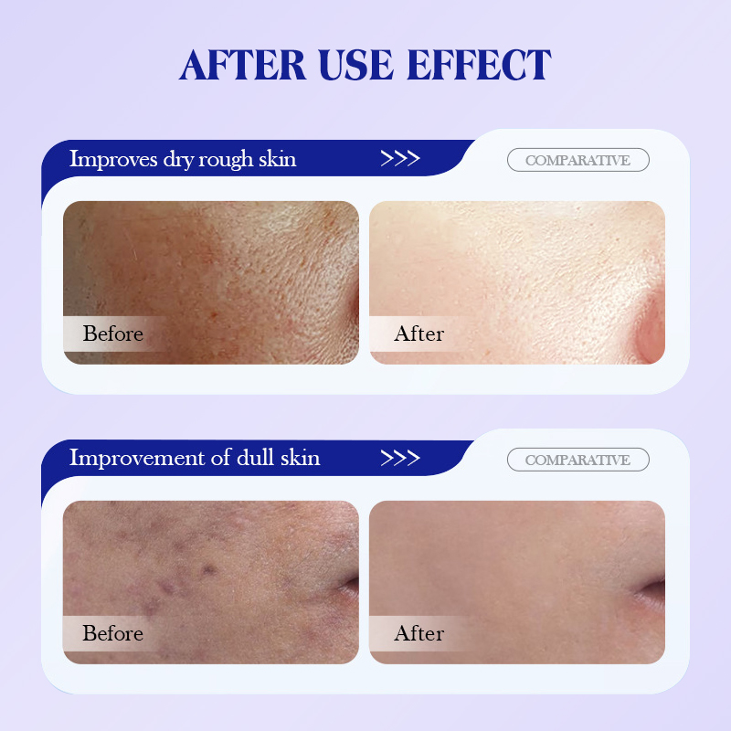 28ml Blueberry collagen facial Mask from an export-oriented cross-border skincare manufacturer for hydrating, moisturizing, oil control and deep cleansing Application Scenario