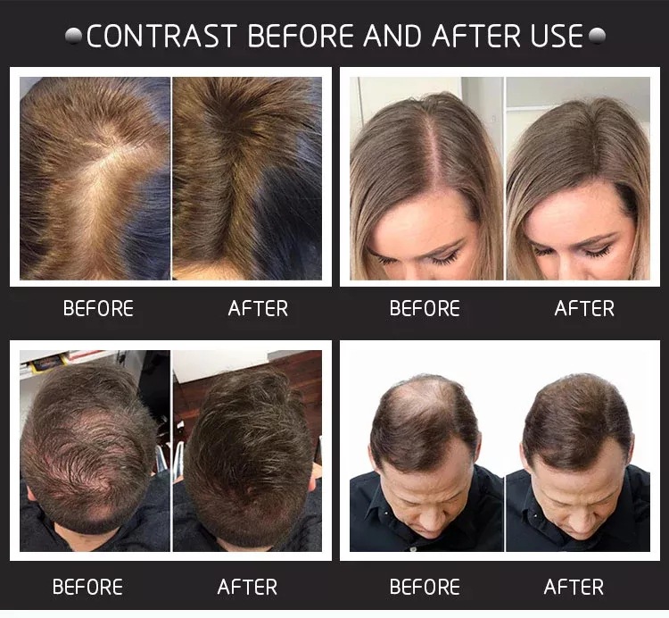 27.5g hair fiber thickening fiber hair growth fiber Hair enhancement fiber powder Item Picture