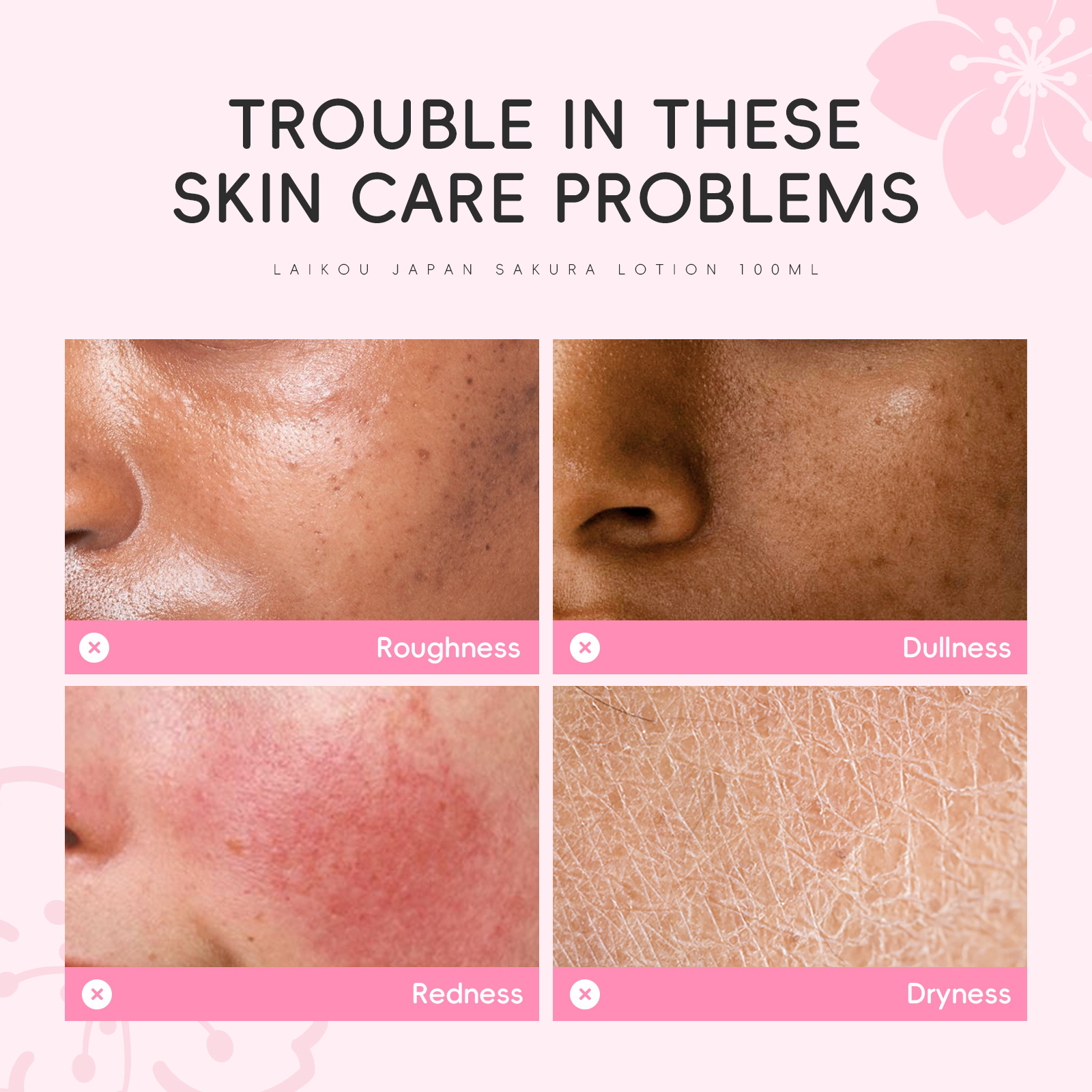 LAIKOU Japanese Cherry Blossom Lotion 100ml Moisturizing and Hydrating Facial Care Products Cross-border Manufacturer details Picture
