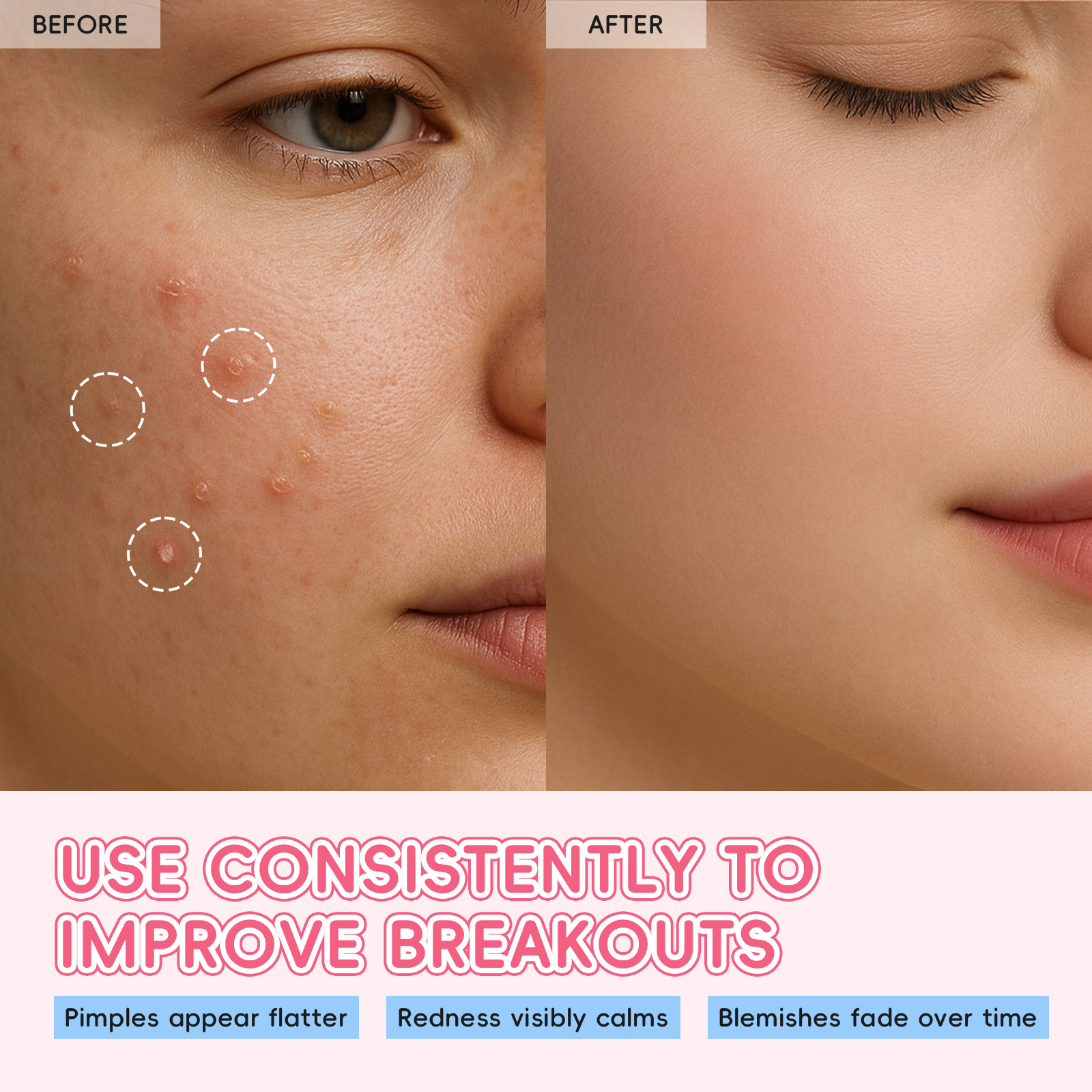 Cross-border new product Laikou Japanese Cherry Blossom Acne PATCHES 24 PATCHES Concealing Beauty Acne Patches 24 Discounted goods Specification drawing