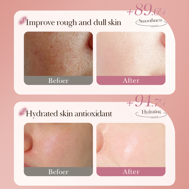 Dear she Tomato Hyaluronic Acid Moisturizing Mask Sheet Set Moisturizing, Nourishing, Brightening and Softening Skin Breathable Sheet Mask Wholesale Item Picture