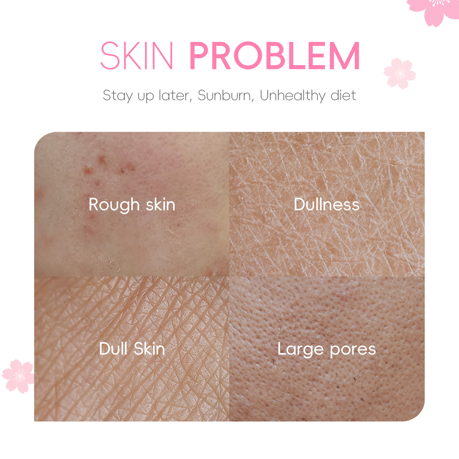 Cross-border FENYI Japanese Cherry Blossom Sleeping Mask 3gx20 Pieces Hydrating and Moisturizing Export Mask, All in English Application Scenario