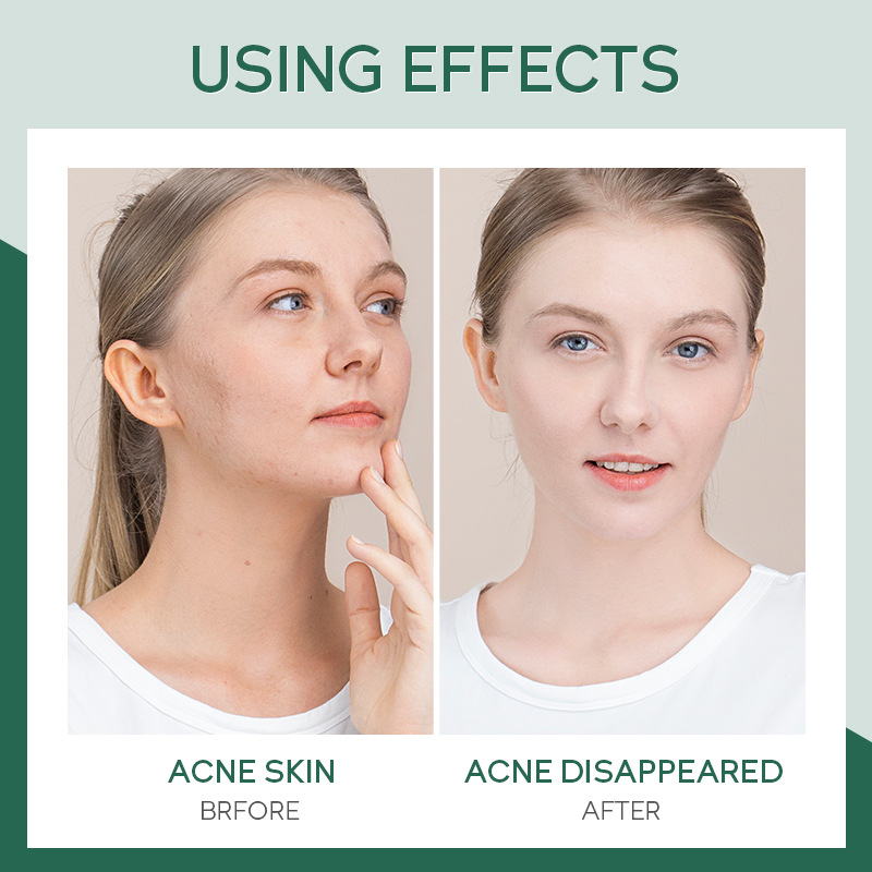 FENYI Fenyi Tea Tree Essence 17ml Facial Moisturizing and Hydrating Skin Care Products Cross-border Supply Manufacturer wholesale Specification drawing