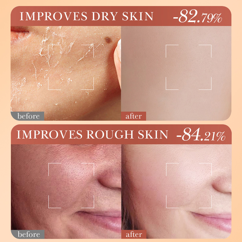 Cross-border Dear she Carrot Mask 28g Hydrating, Moisturizing and Nourishing Skin Sheet set Wholesale from foreign trade manufacturer Application Scenario