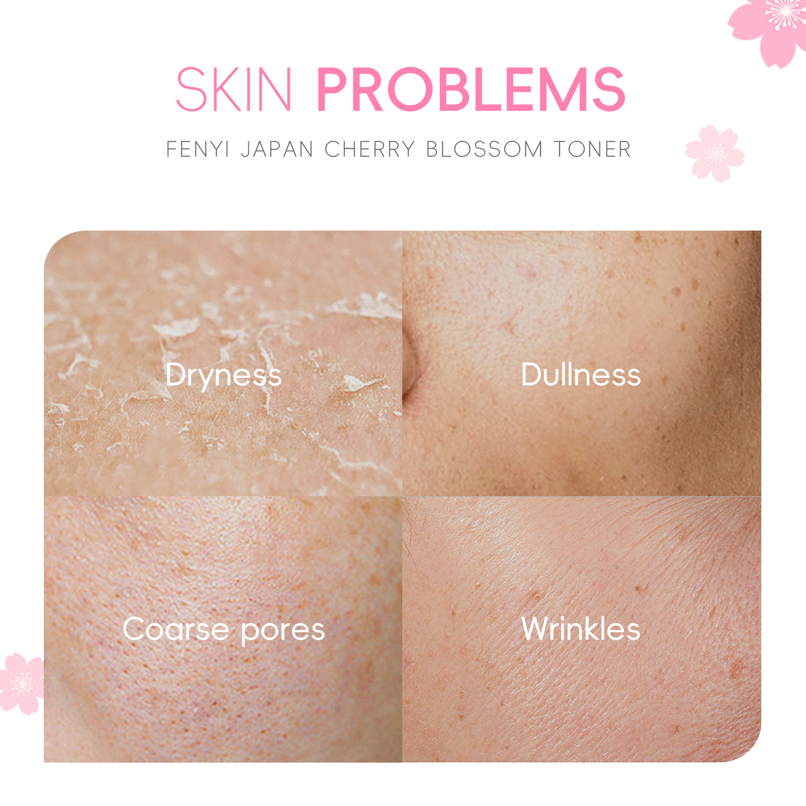 Cross-border fenyi Japanese Cherry Blossom Toner Wet Compress 100ml Hydrating, Moisturizing and Nourishing skin care products for export details Picture