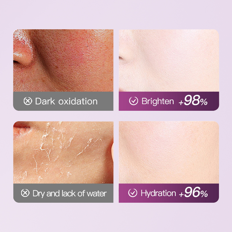 Dear she Grape Antioxidant Hydrating Facial mask Moisturizing and Softening Fruit Mask Cross-border Wholesale Customization Item Picture