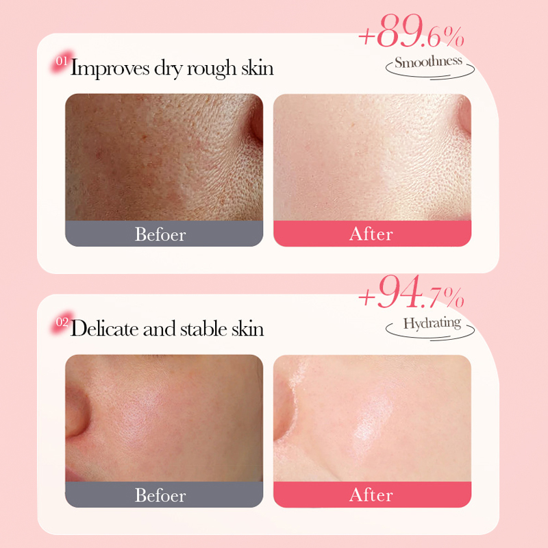 Dear she Fruit Mask, Peach Brightening Moisturizing Mask, cross-border export wholesale, customizable Application Scenario