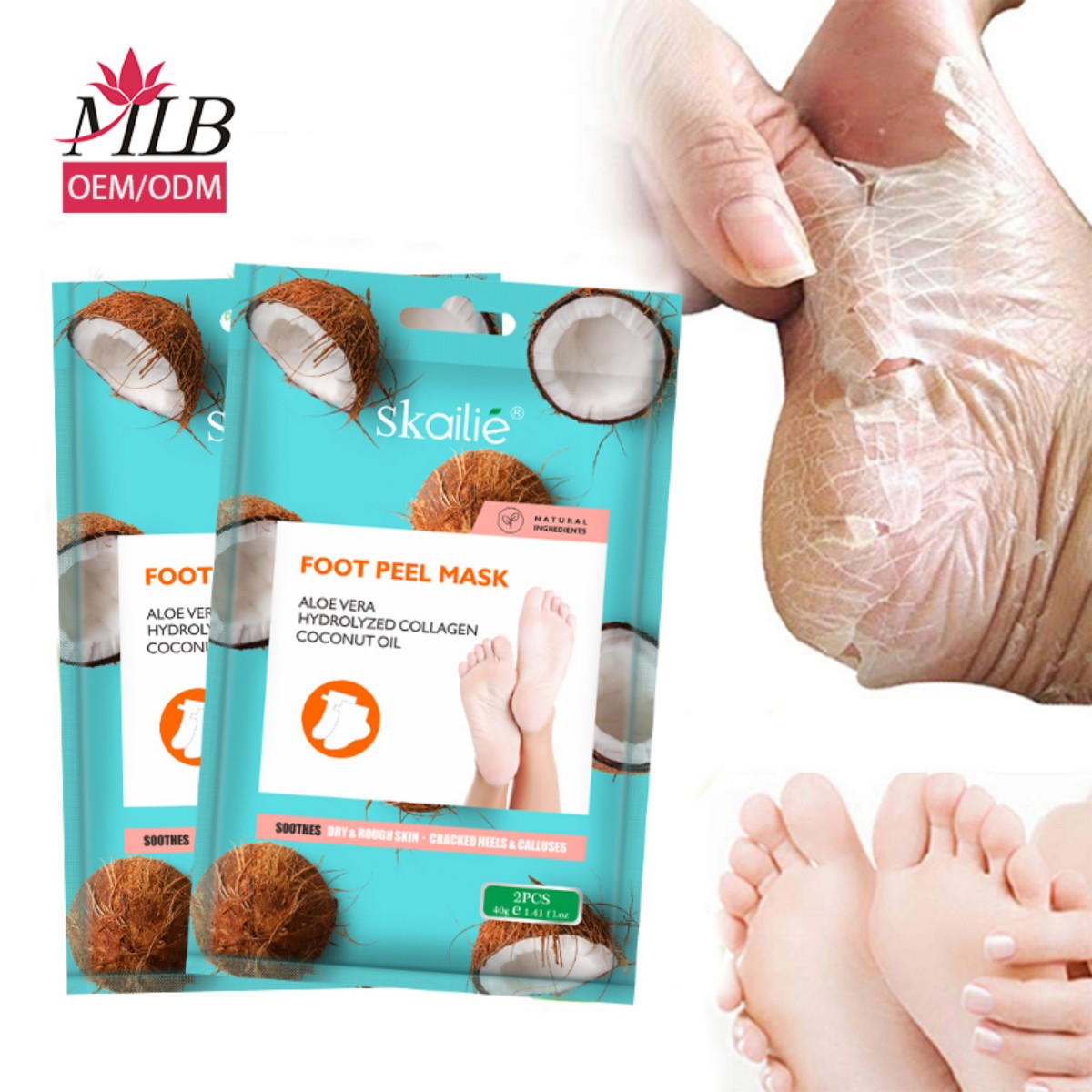 Skailie 40g/Coconut Function Foot Mask: OEM Self-owned Brand Organic Anti-callus and Crack Moisturizing Foot Mask (Natural Exfoliating Coconut Foot Skin Mask) Application Scenario