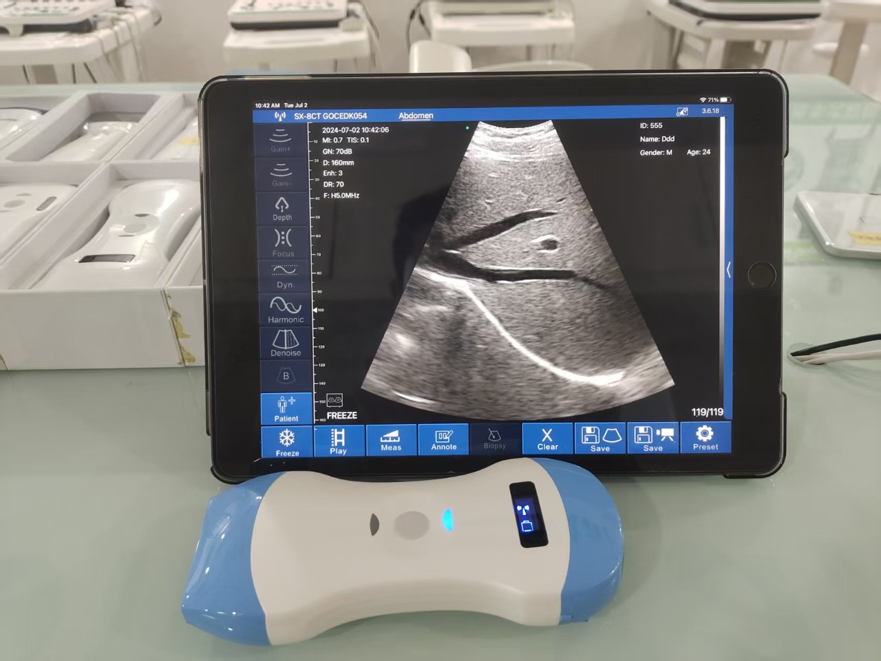 Handheld ultrasound, handheld B-ultrasound, wireless ultrasound, wireless ultrasound machine Application Scenario