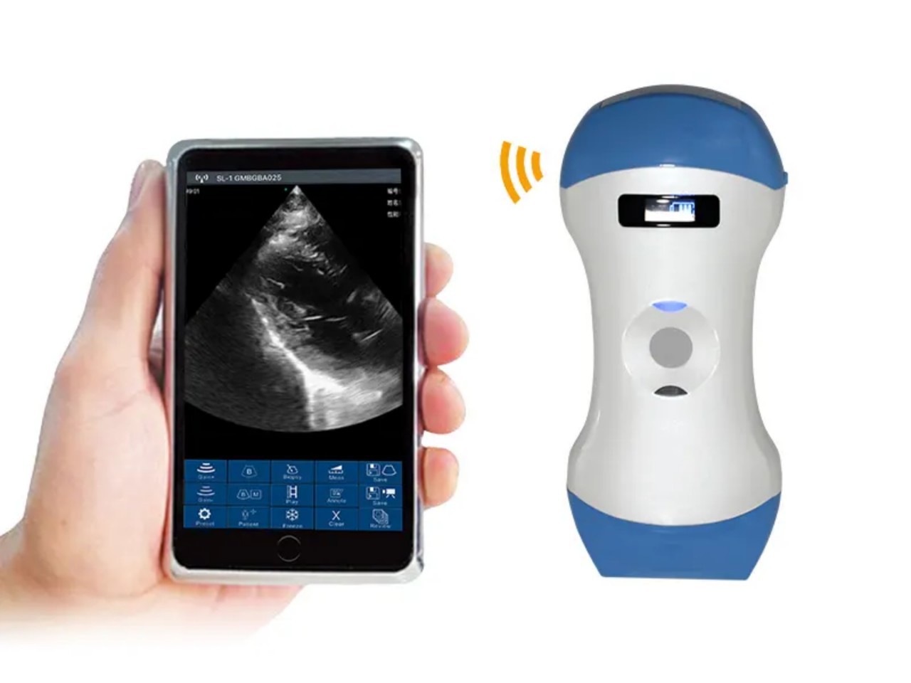 Handheld ultrasound, handheld B-ultrasound, wireless ultrasound, wireless ultrasound machine