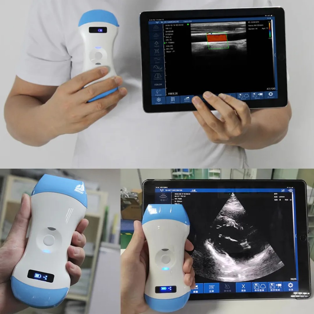 Handheld ultrasound, handheld B-ultrasound, wireless ultrasound, wireless ultrasound machine details Picture