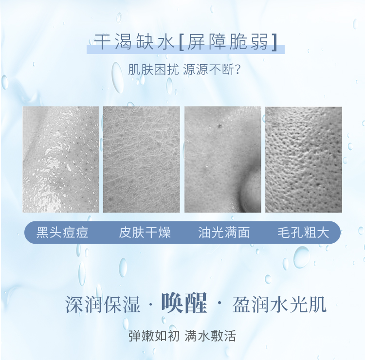 悠然小铺积雪草舒缓干燥 军训晒后换季多场景修护急救冰感面膜 褪红补水保湿正品 详情2