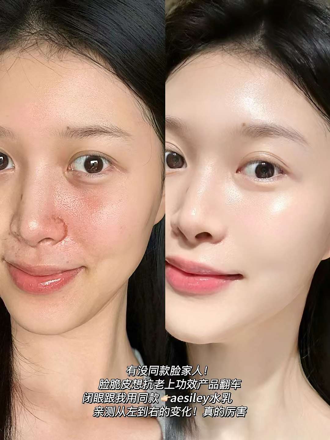 Ms. Elena Roton's British light luxury skincare Aesiley lotion is on sale at a special price detail image 7