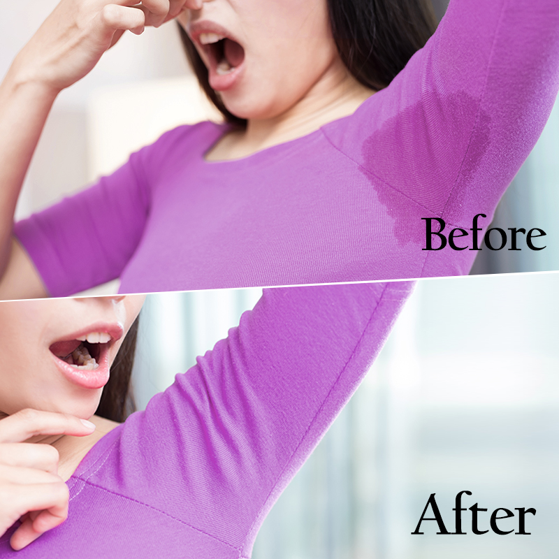 Antiperspirant Deodorant Spray, factory customized armpit spray, long-lasting fragrance, antiperspirant and deodorant Application Scenario