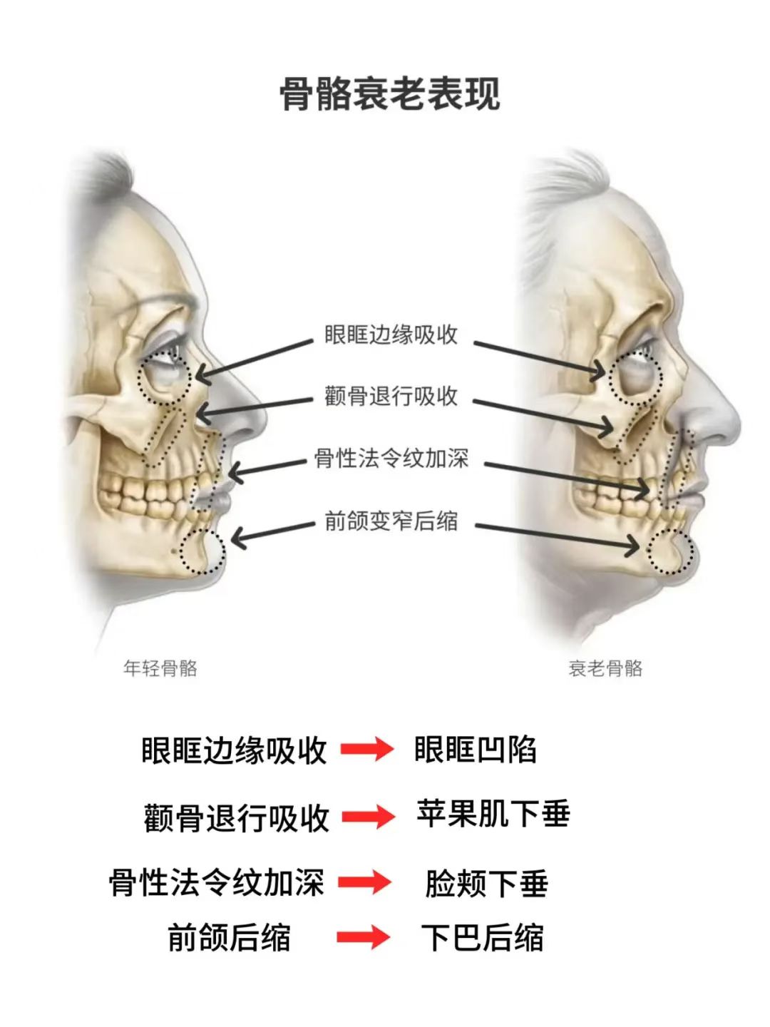 软骨素多重细胞抗衰紧致发光面膜Super beautyface  Mask详情图3