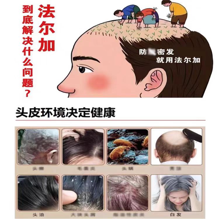 法尔加神清目明套盒 法尔加皮肤抑菌液 官方旗舰D法尔加 精油 义乌市经销代理商详情8