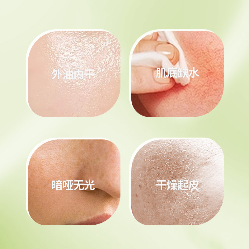 【解救肌渴】专利马齿苋补水保湿喷雾 降温爽肤湿敷滋润保湿喷雾详情6