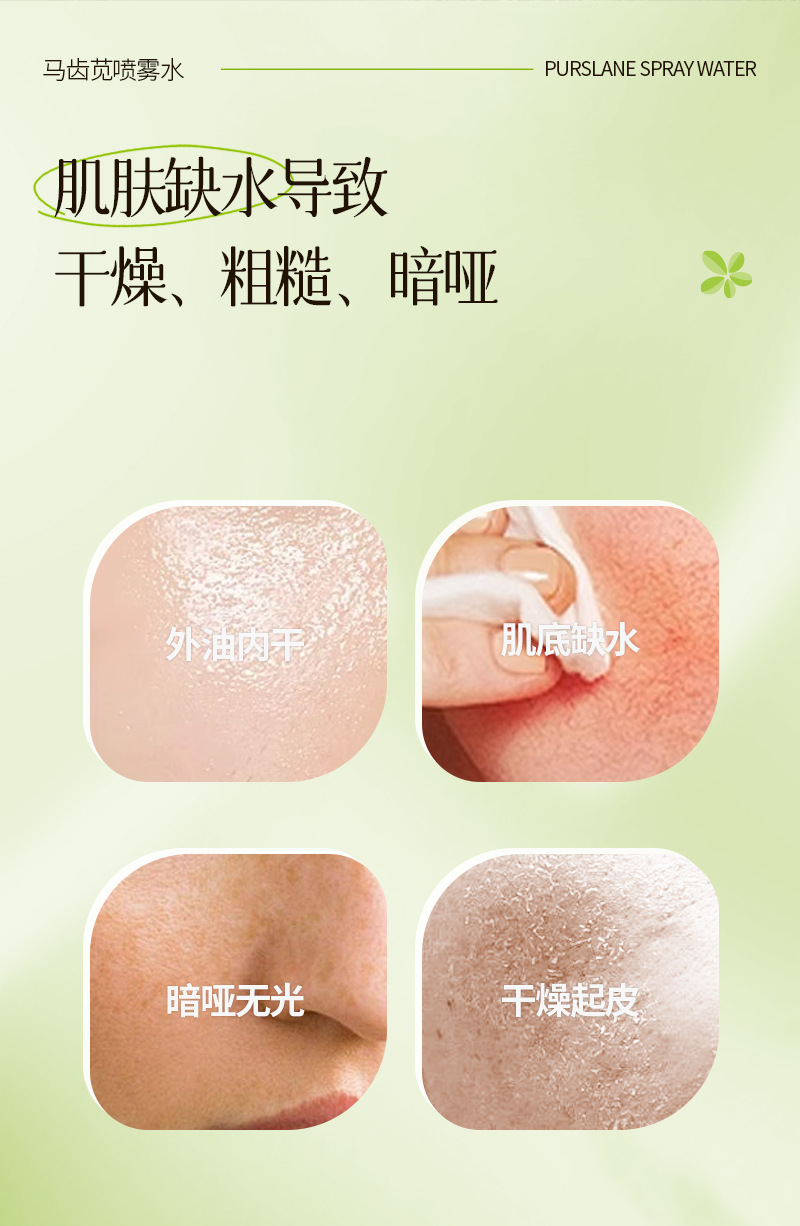 【解救肌渴】专利马齿苋补水保湿喷雾 降温爽肤湿敷滋润保湿喷雾详情4
