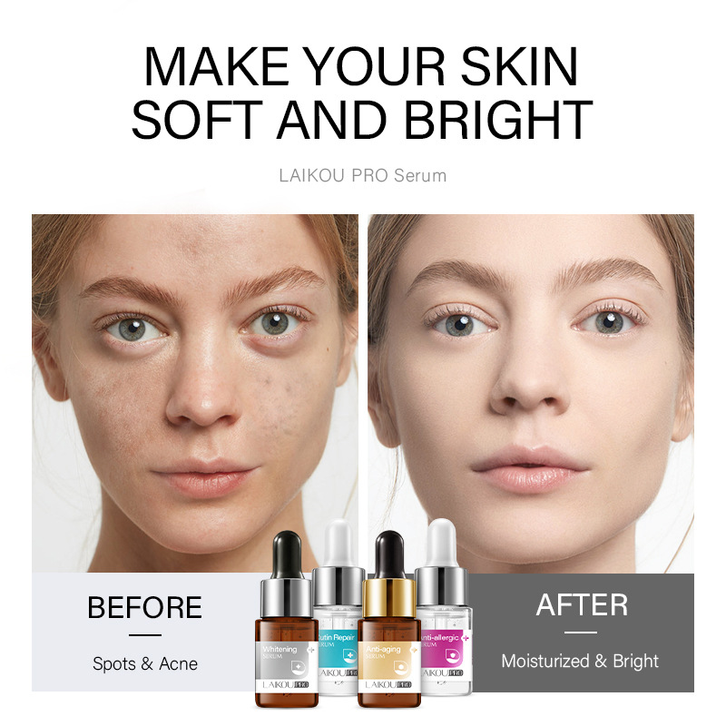 LAIKOU PRO Four-Color Essence 12ml Hydrating and Moisturizing Skin Care product, English packaging, cross-border supply Application Scenario