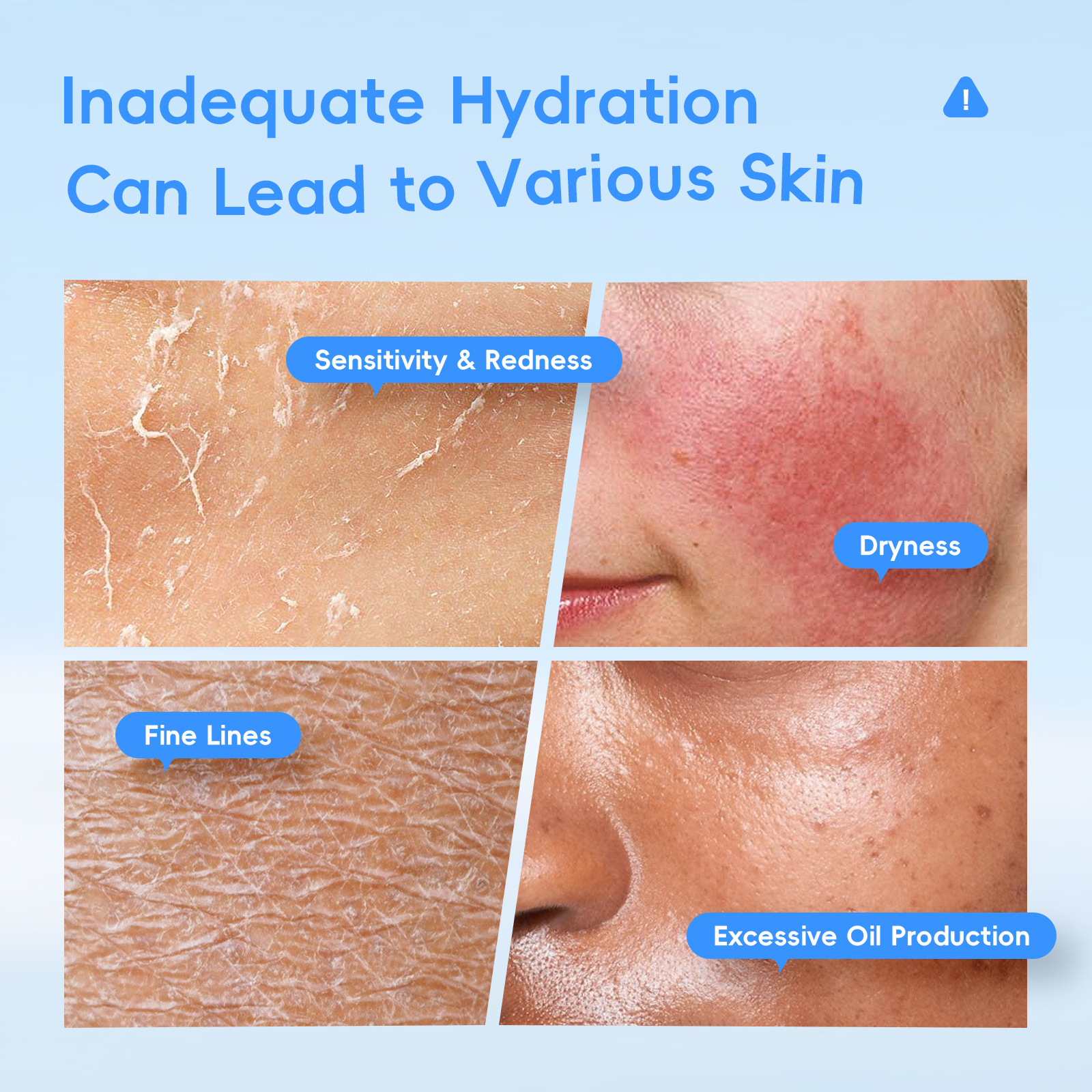 Cross-border LAIKOU Hyaluronic Acid Collagen toner 100ml Hydrating and Moisturizing All-English export Toner details Picture