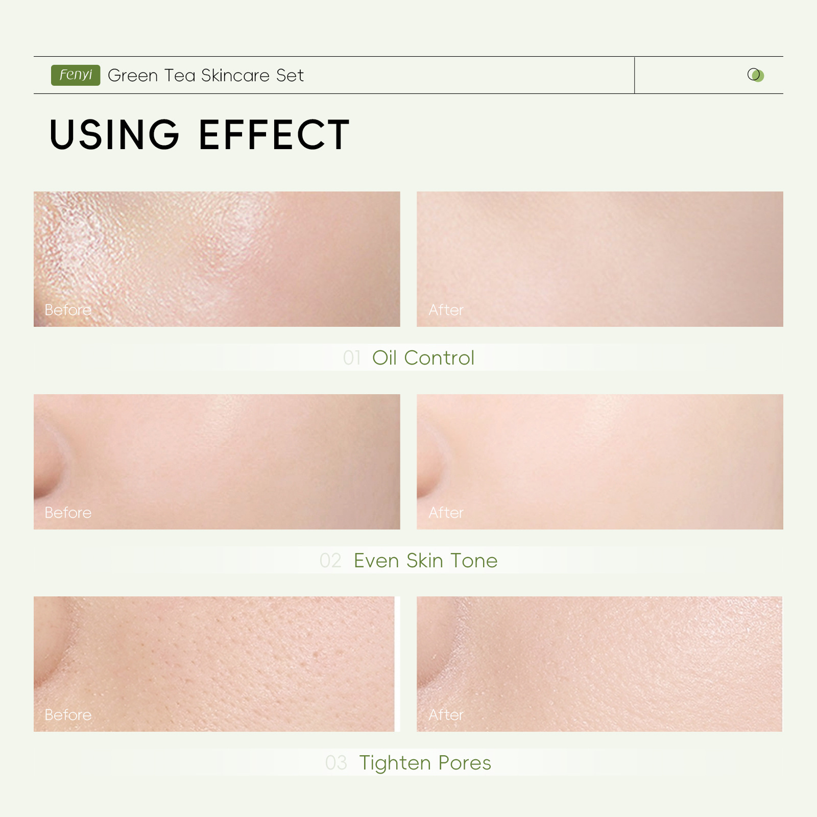Cross-border FENYI Green Tea Series skin care product combination set Hydrating and Moisturizing Mask in full English packaging for export details Picture