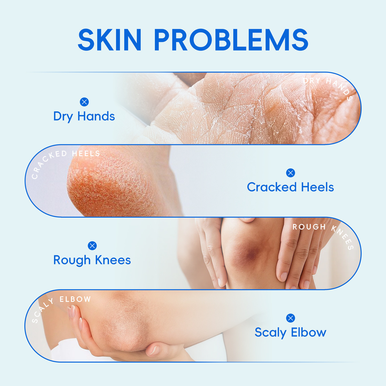 Cross-border new product LAIKOU Urine Cream 100g hydrating and moisturizing FDA skin care product in stock for export, all in English Specification drawing