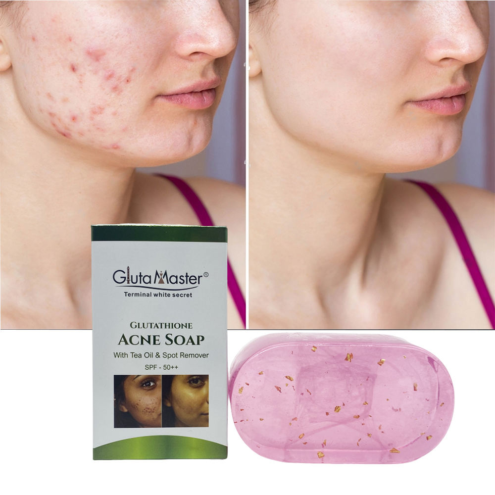 Gluta Master Glutathione Acne Pimples Soap Tea Oil Soap