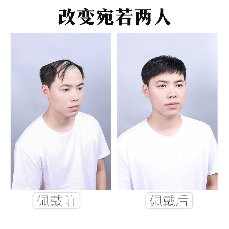 men's hair supplementing piece wig sheath head hair replacement forehead bald hair replacement pad hair extension flip wig real hair toupee details Picture