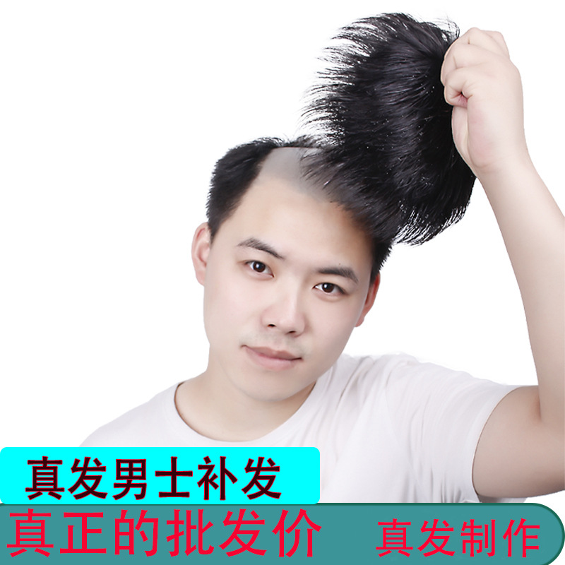 men's hair supplementing piece wig sheath head hair replacement forehead bald hair replacement pad hair extension flip wig real hair toupee full figure