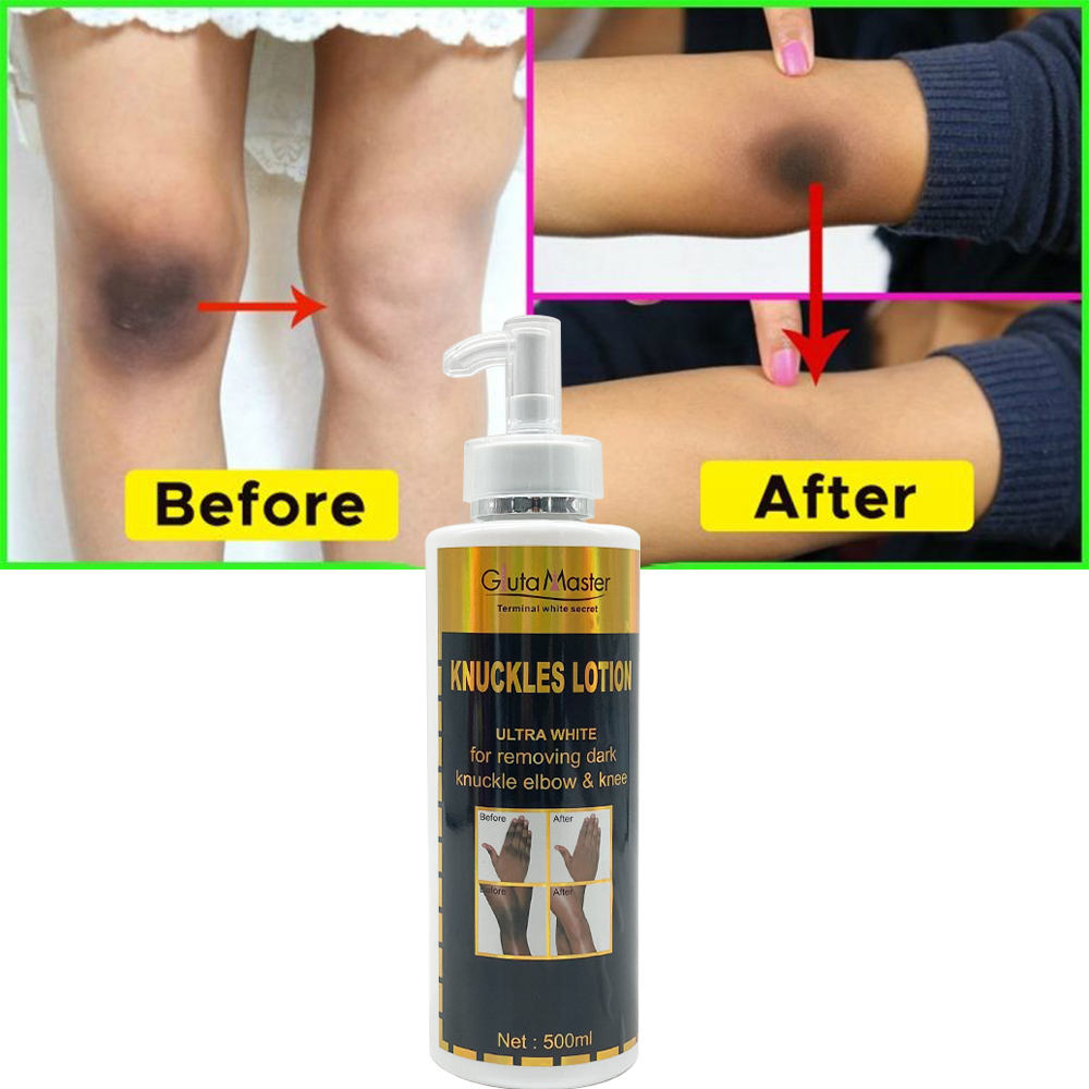 Gluta Master High Quality Best Knuckles Lotion  Body Cream 