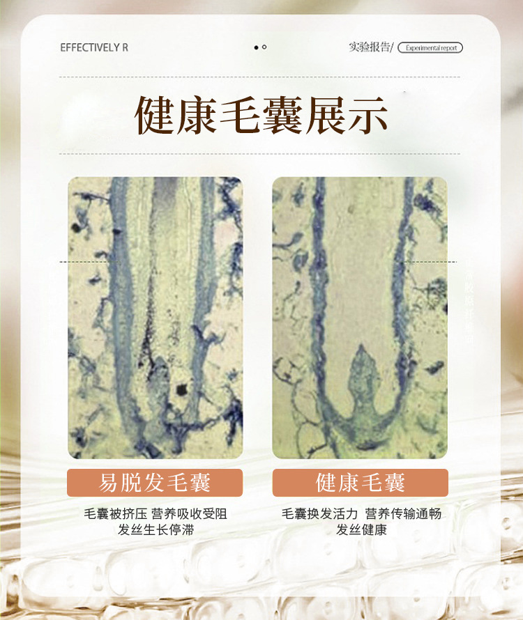 Ginger essence anti-hair loss shampoo, scientific care, strengthening hair roots, 20 years of professional quality guarantee. pic 10